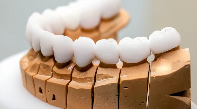 Porselen Diş Kaplamaları Nasıl Yapılır?